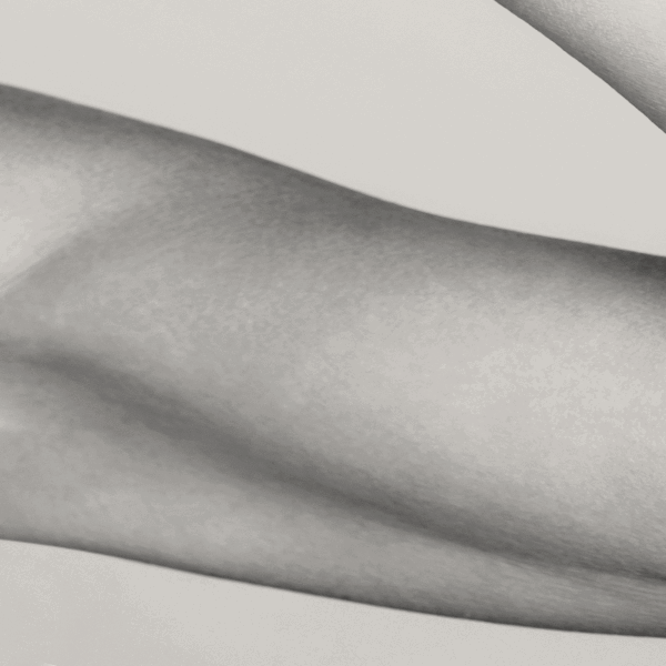 bovenarmen verstrakken