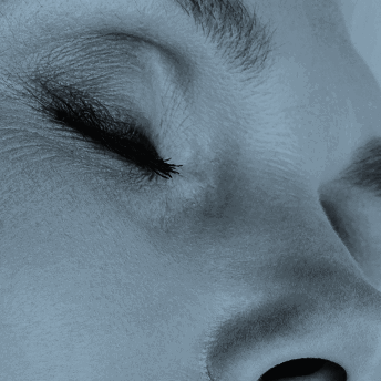 bovenooglidcorrectie