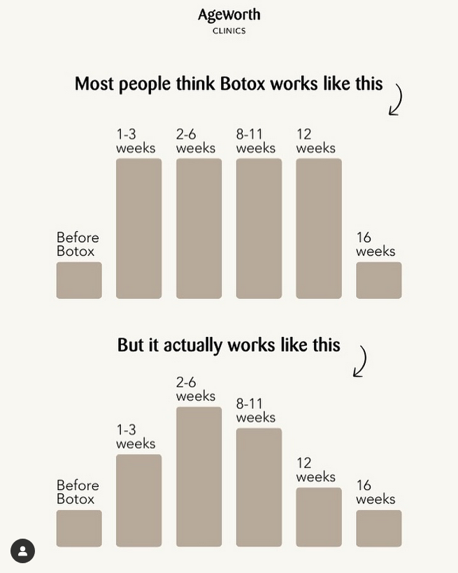 Hoe lang werkt botox