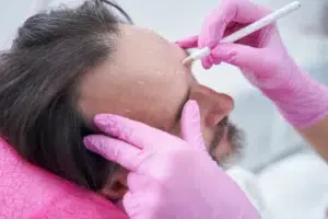 Voorhoofd rimpel botox man