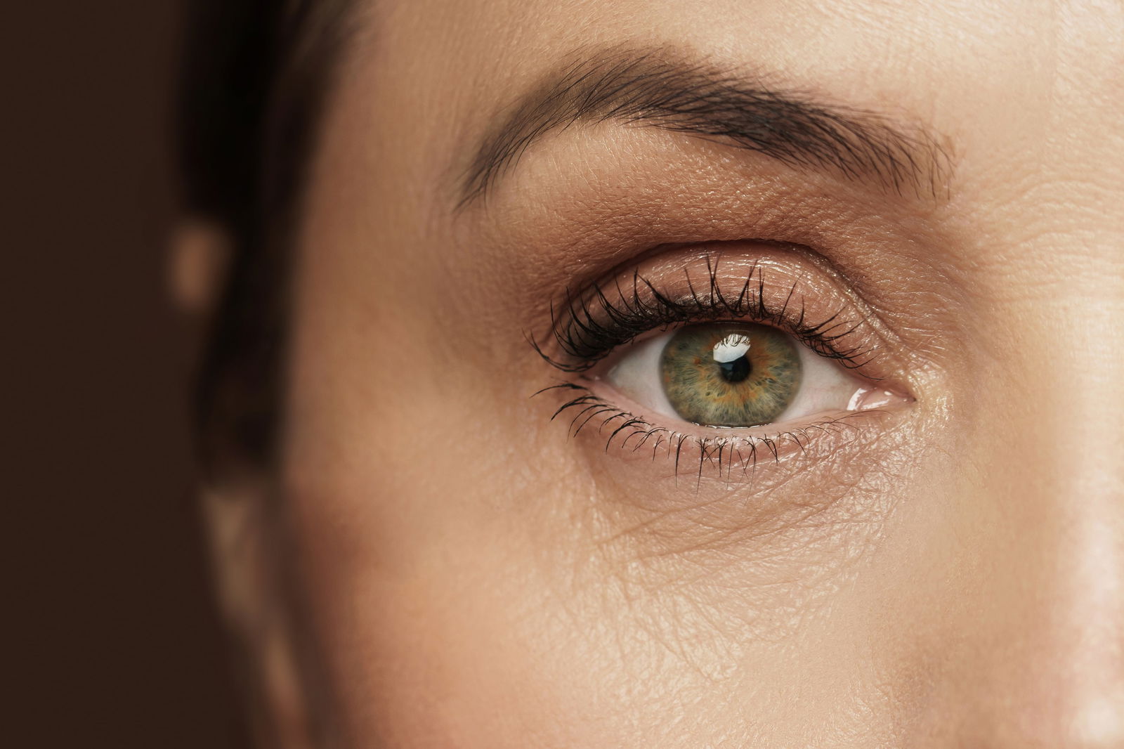 Botox kraaienpootjes: behandeling, kosten en voordelen