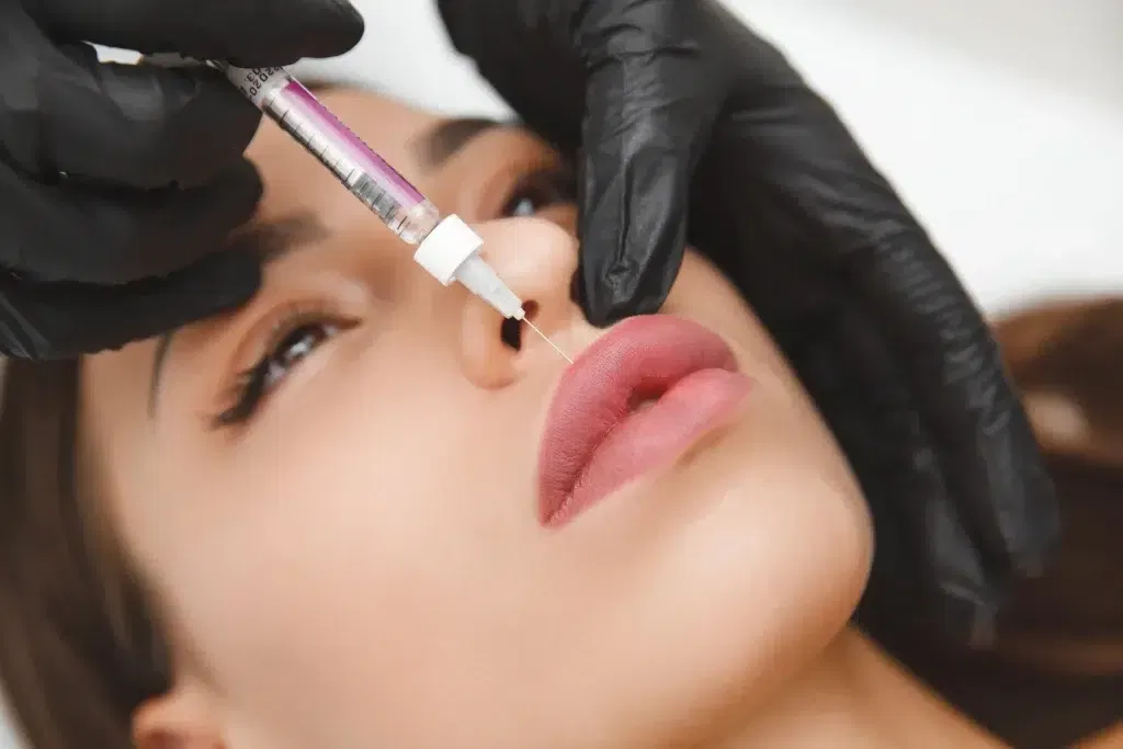 Minimum leeftijd lipfillers