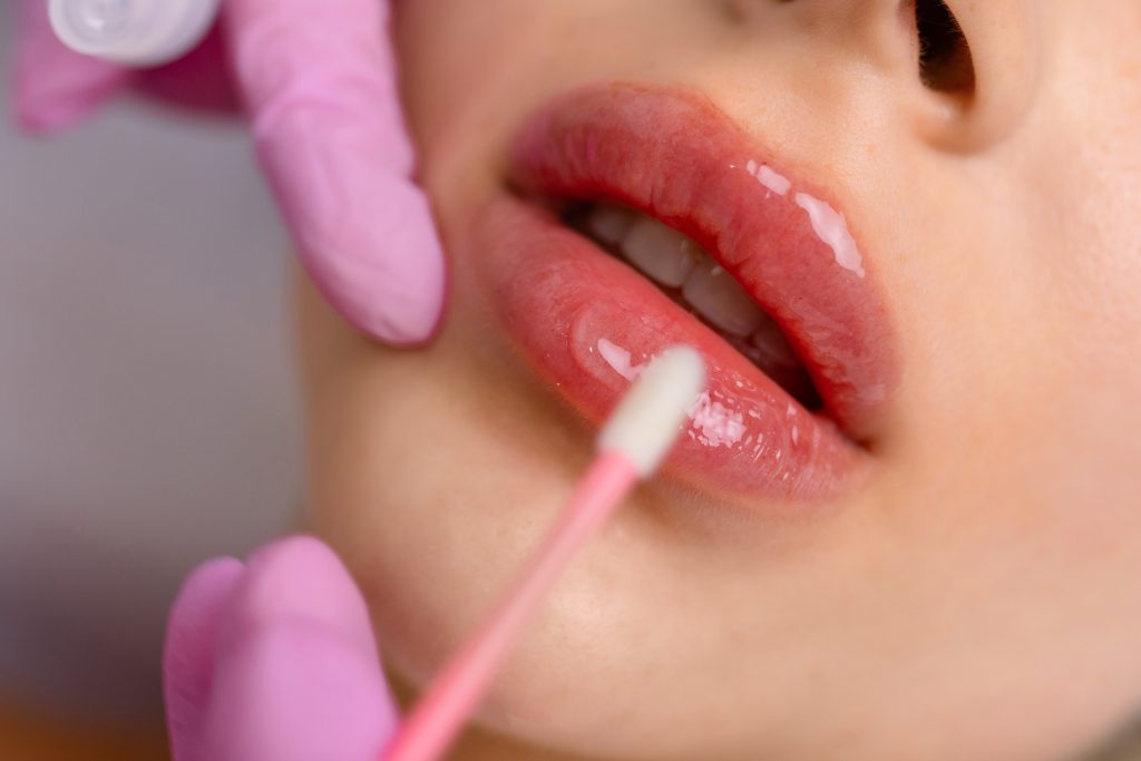Natuurlijke lipfillers