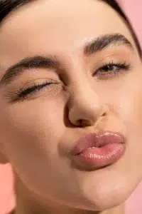 niet zoenen na lipfillers