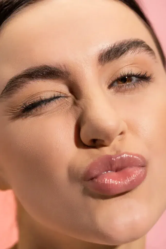 niet zoenen na lipfillers