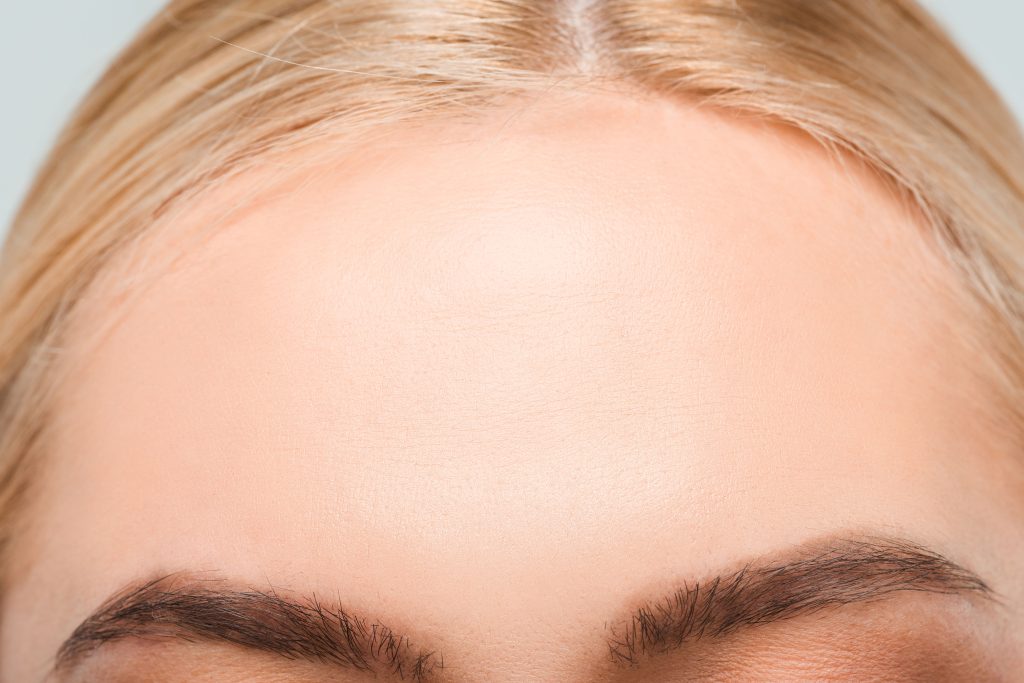 Voorhoofdrimpels botox Ageworth-min