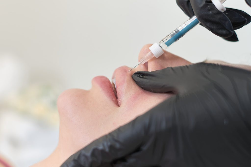 opgespoten lippen voor na