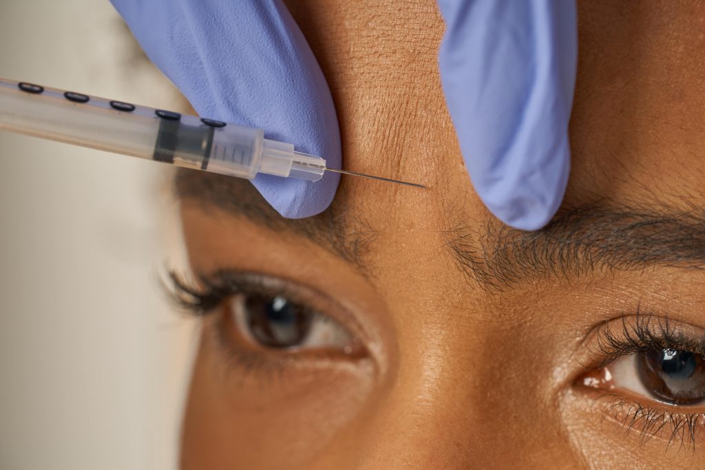 Botox prijs fronsrimpel