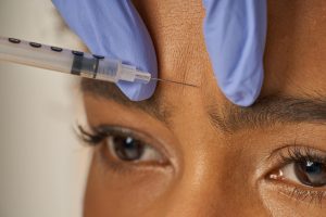 Botox prijs fronsrimpel