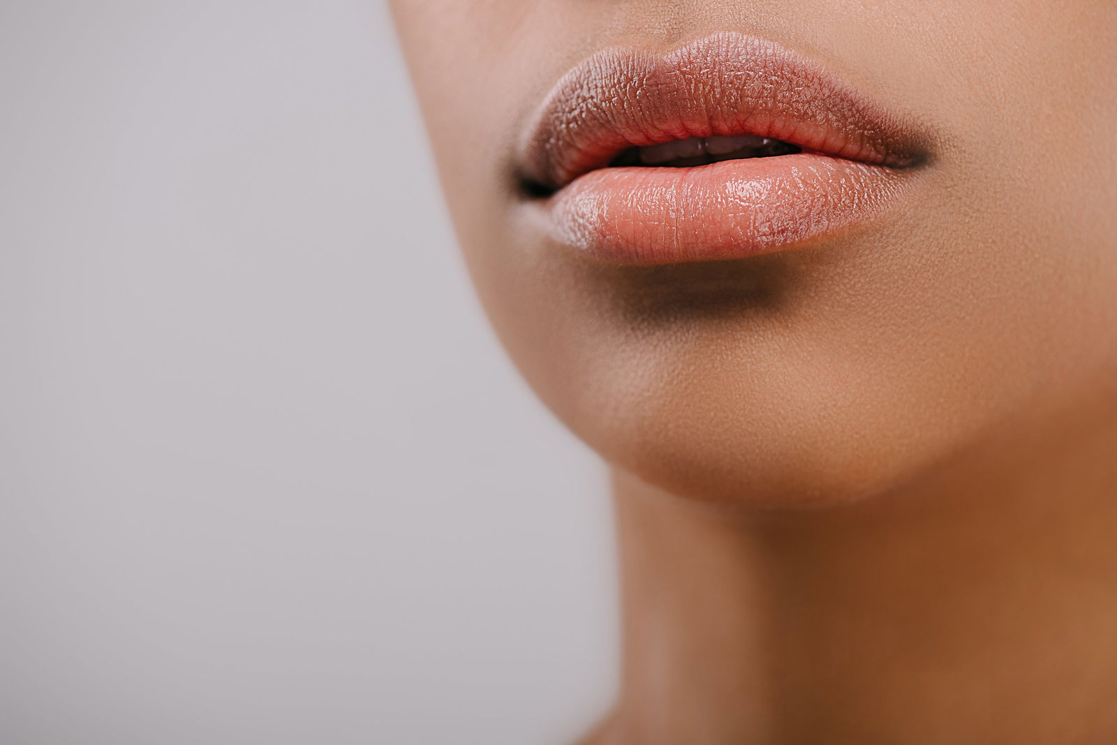 Lipfillers Apeldoorn zwelling
