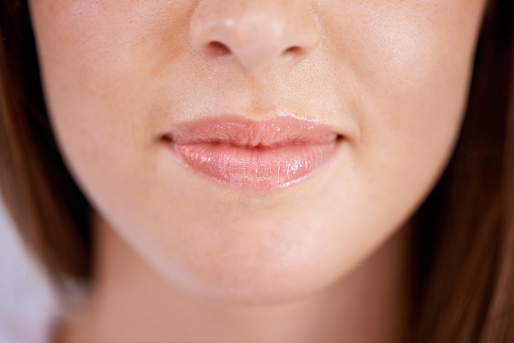 Botox lipflip