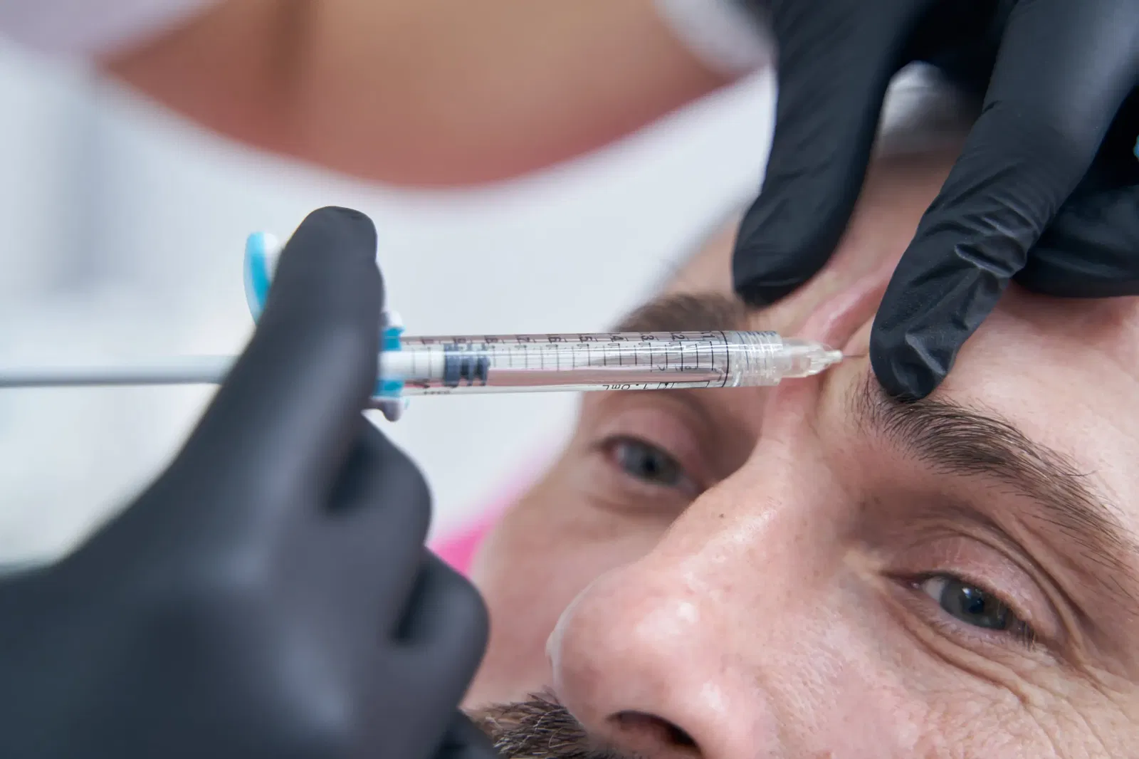 Botox mannen fronsrimpel
