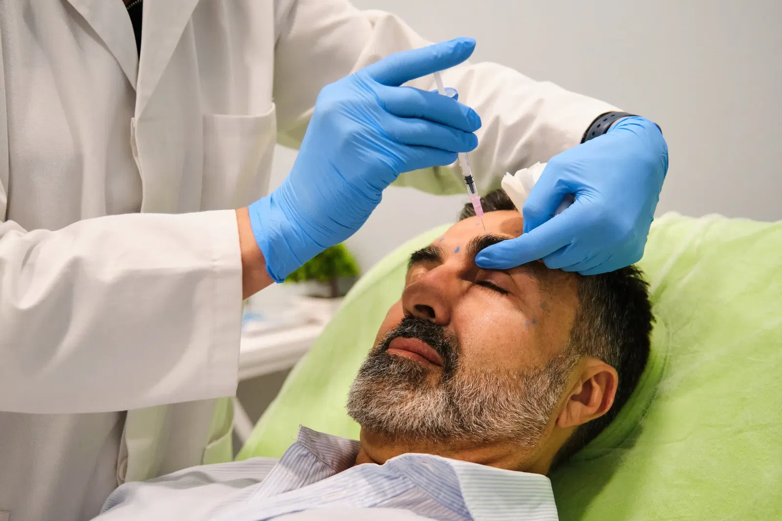Botox vragen mannen
