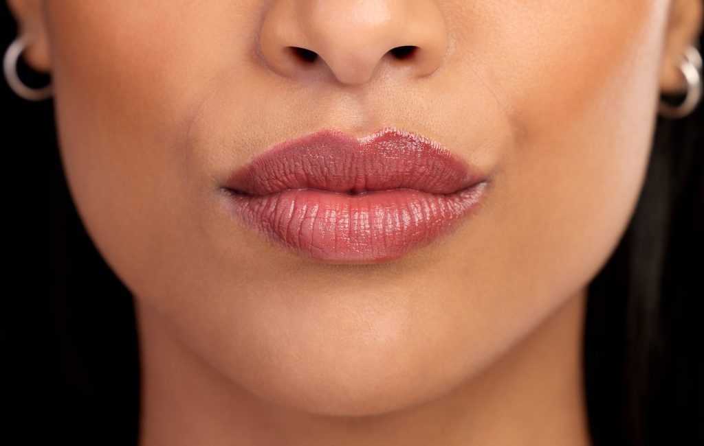 botox lips