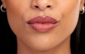 botox lips