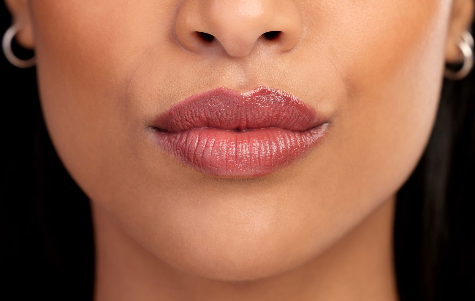 botox lips