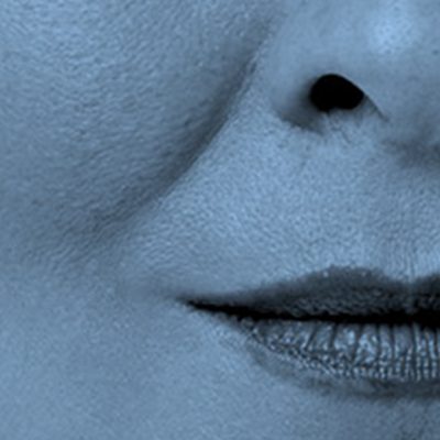 Chemical Peel Ageworth