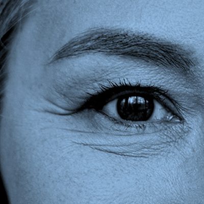 Eyebrow lift Ageworth vierkant