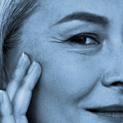 Lower Eyelid Correction Ageworth vierkant